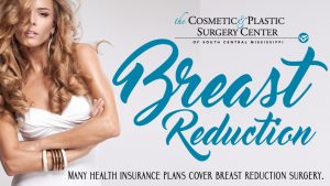 breast-reduction-surgery